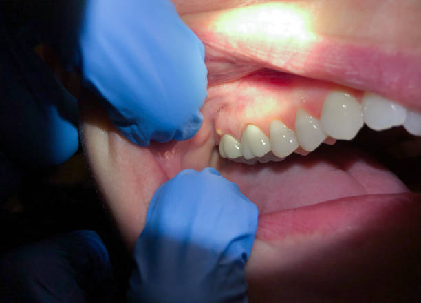 Best Weekend Emergency Dentist in Glenside, PA